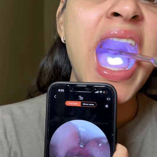 Digg it - Tonsil Stone Remover