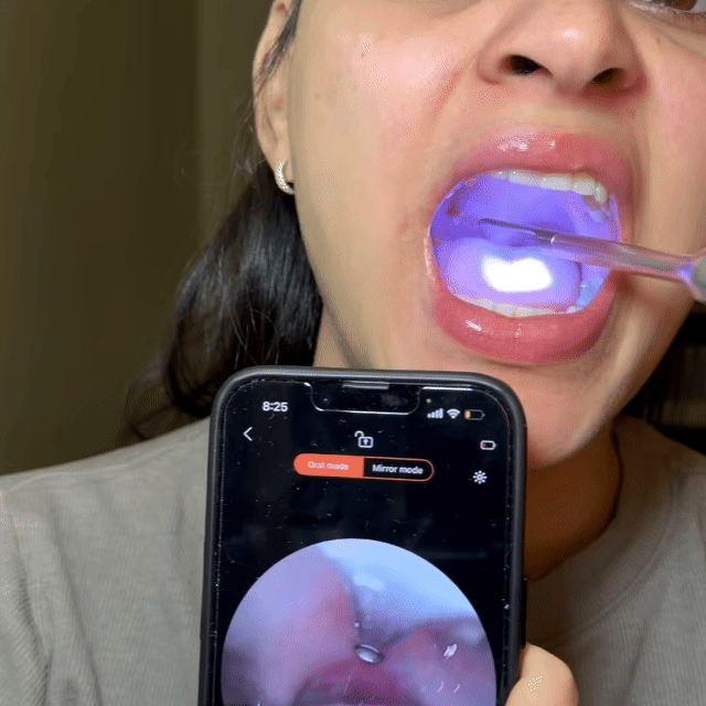 Digg it - Tonsil Stone Remover