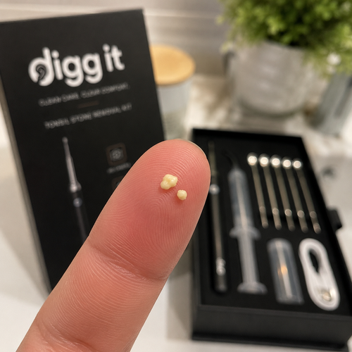 Digg it - Camera Tonsil Stone Remover